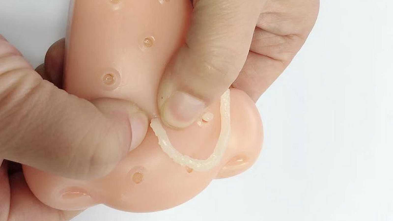 popper per brufoli al naso