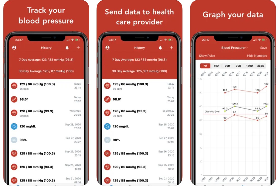 Blutdruck-Tracker-App